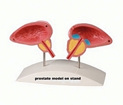 prostate.jpg